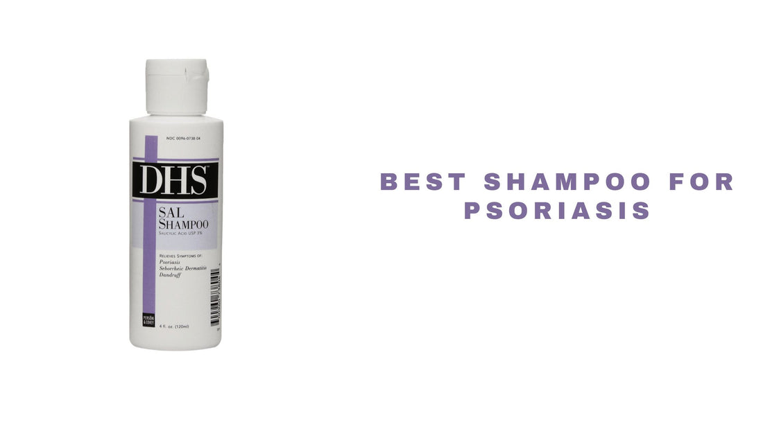 10 Best Shampoo For Psoriasis 2024