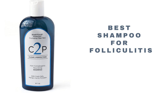 12 Best Shampoo For Folliculitis 2024