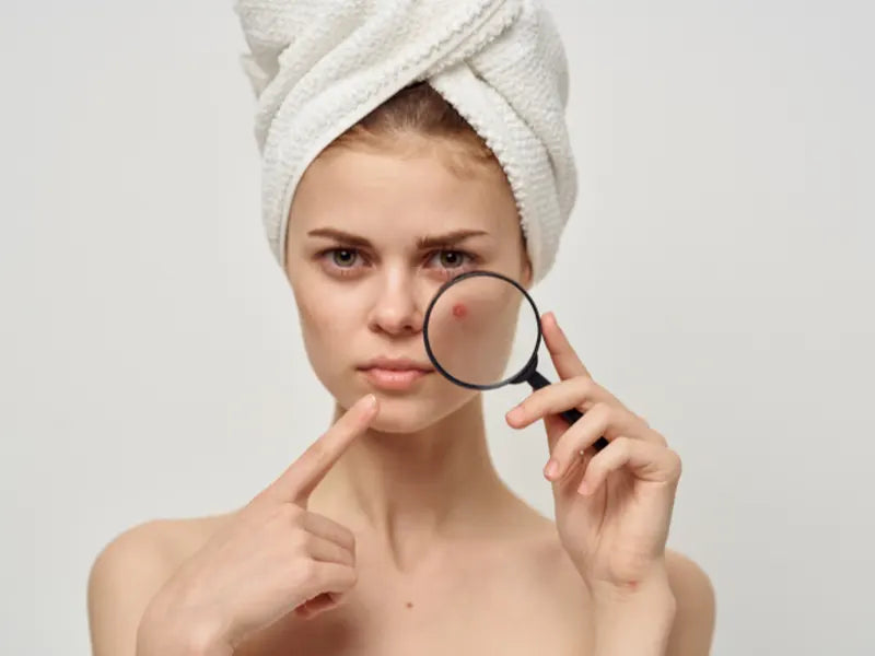 Is airbrush makeup good for acne-prone skin?