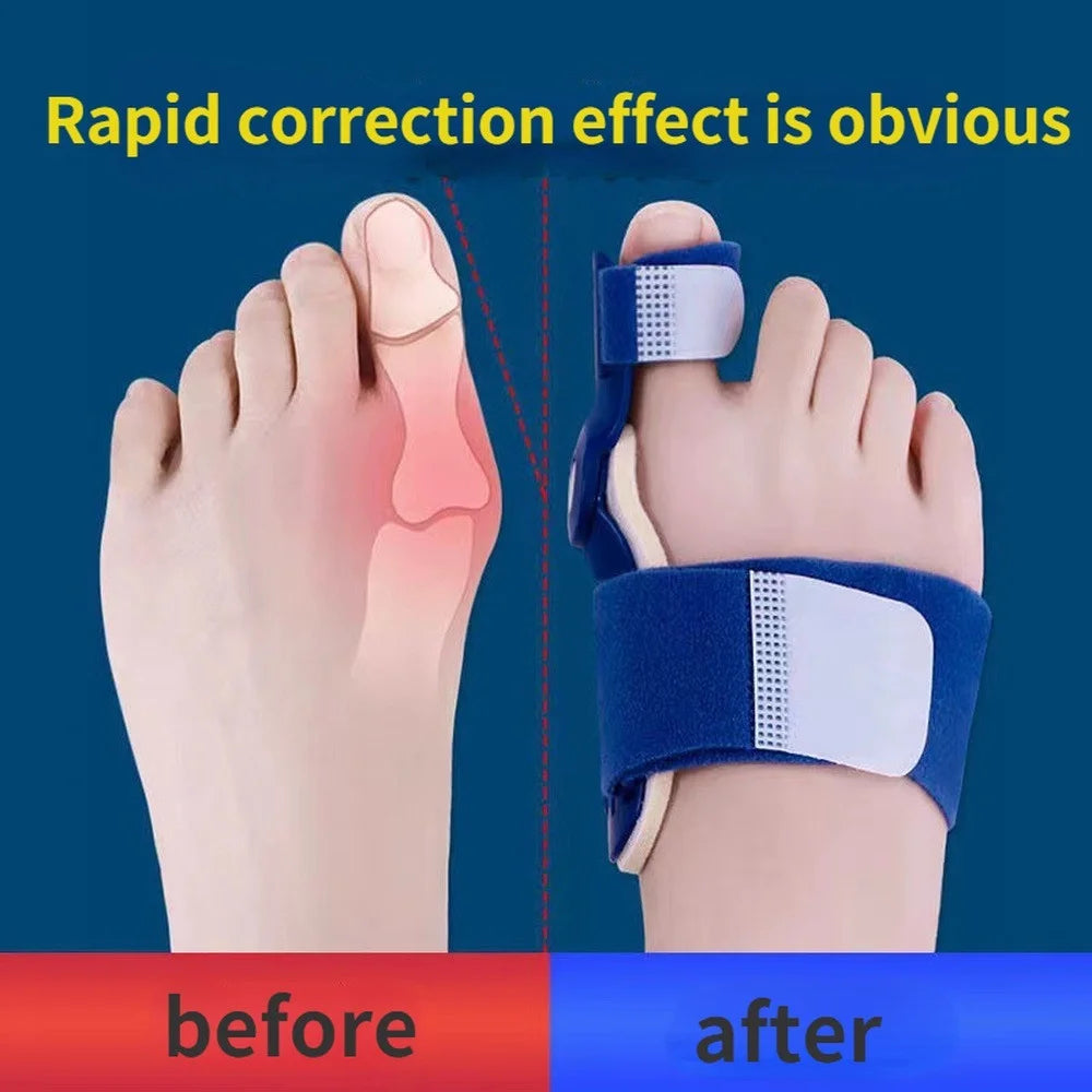 Big Bone Toe Bunion Splint Corrector